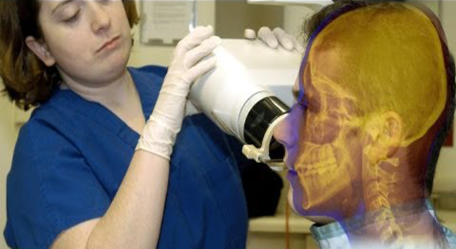 Yearly-Dental-X-rays-Cause-Increased-Likelihood-of-Tumors